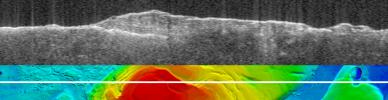 PIA09222: Bright Lower Echo in Radargram of South Polar Layered Deposits