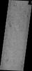 PIA10250: Arcuate Collapse