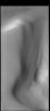 PIA23361: North Polar Layers